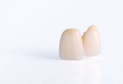 Prótesis y coronas dentales castellón | Bersadent